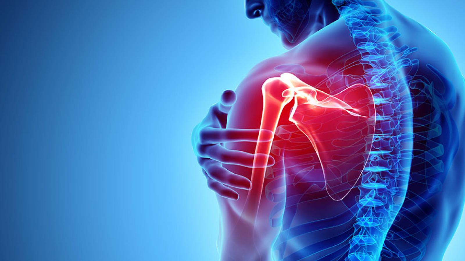 Physiotherapy information for shoulder pain in Zirakpur